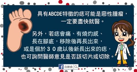 痣很凸|我的「痣」會是惡性腫瘤嗎？醫師告訴你：符合這5特。